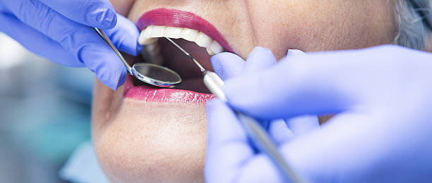 Best Emergency Dental Extractions in Vancleave, MS